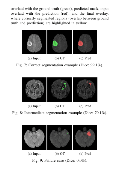 O Papel das Sequências de RM na Generalização Cross-Dataset para Segmentação de Tumor Cerebral